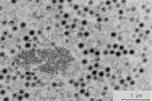 LymphoD8.gif