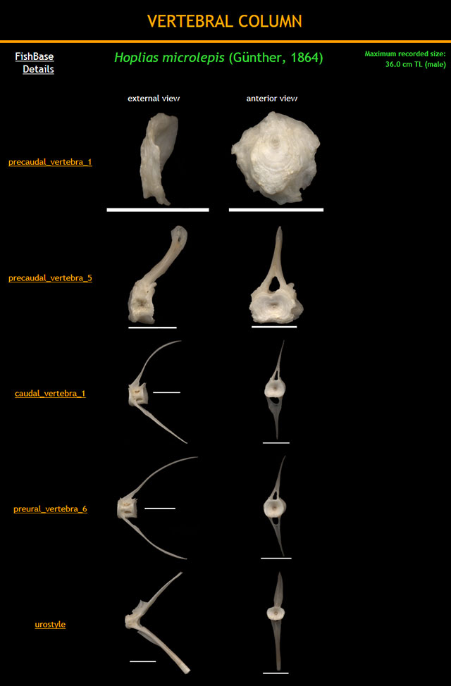 Hoplias microlepis